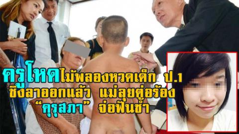 ครูไม้พลองหวดเด็กป.1 ชิงลาออกแล้ว แม่ลุยต่อร้อง “คุรุสภา” จ่อฟันซ้ำ